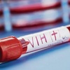 Logo #Conversatorio: El infectólogo Hugo Roland sobre VIH-Sida y las Enfermedades de transmisión sexual