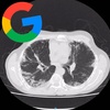 Logo Google y su IA capaz de predecir cáncer de pulmón mejor que los médicos
