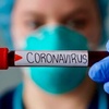 Logo Coronavirus: Colón, preocupación por el aumento de casos