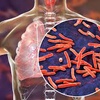 Logo Tuberculosis en Argentina, una epidemia que persiste